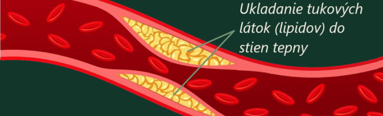 Cholesterol, lipidy, kôrnatenie tepien